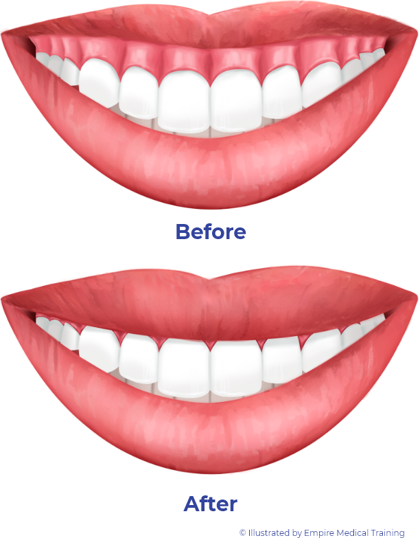 Sonrisa colgate