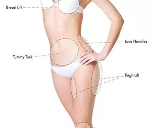 Banner de tratamiento de hilo PDO para el abdomen