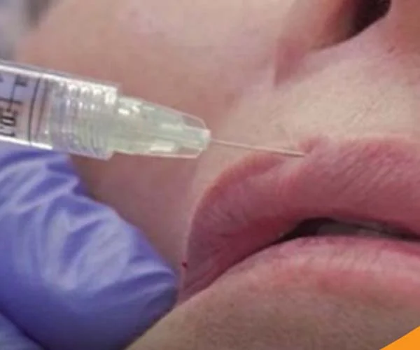 Banner del blog de tipos de labios