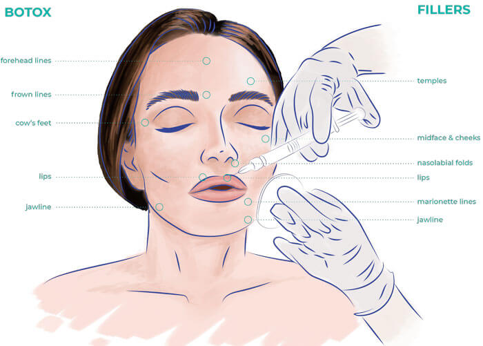 banner botulina avanzada