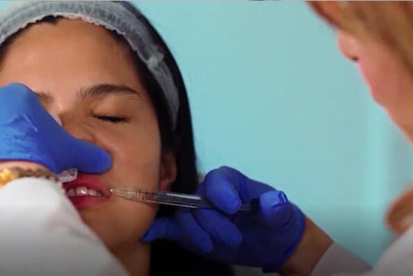 Imagen de técnicas avanzadas de rellenos de labios