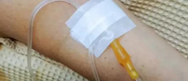 Nutricion de suero