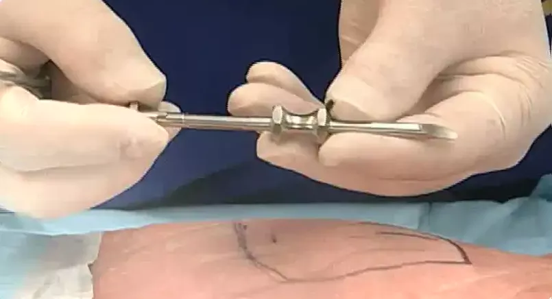 terapia hormonal inyeccion 