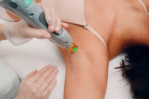 Curso de Láser Cosmético