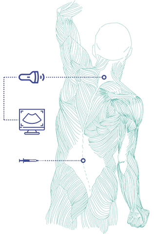 Ilustración de manejo del dolor